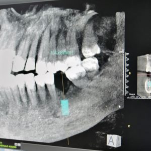 radiodiagnostico-en-3d